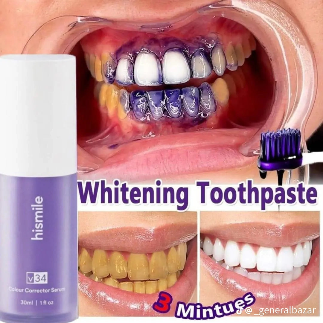 Tooth Whitening