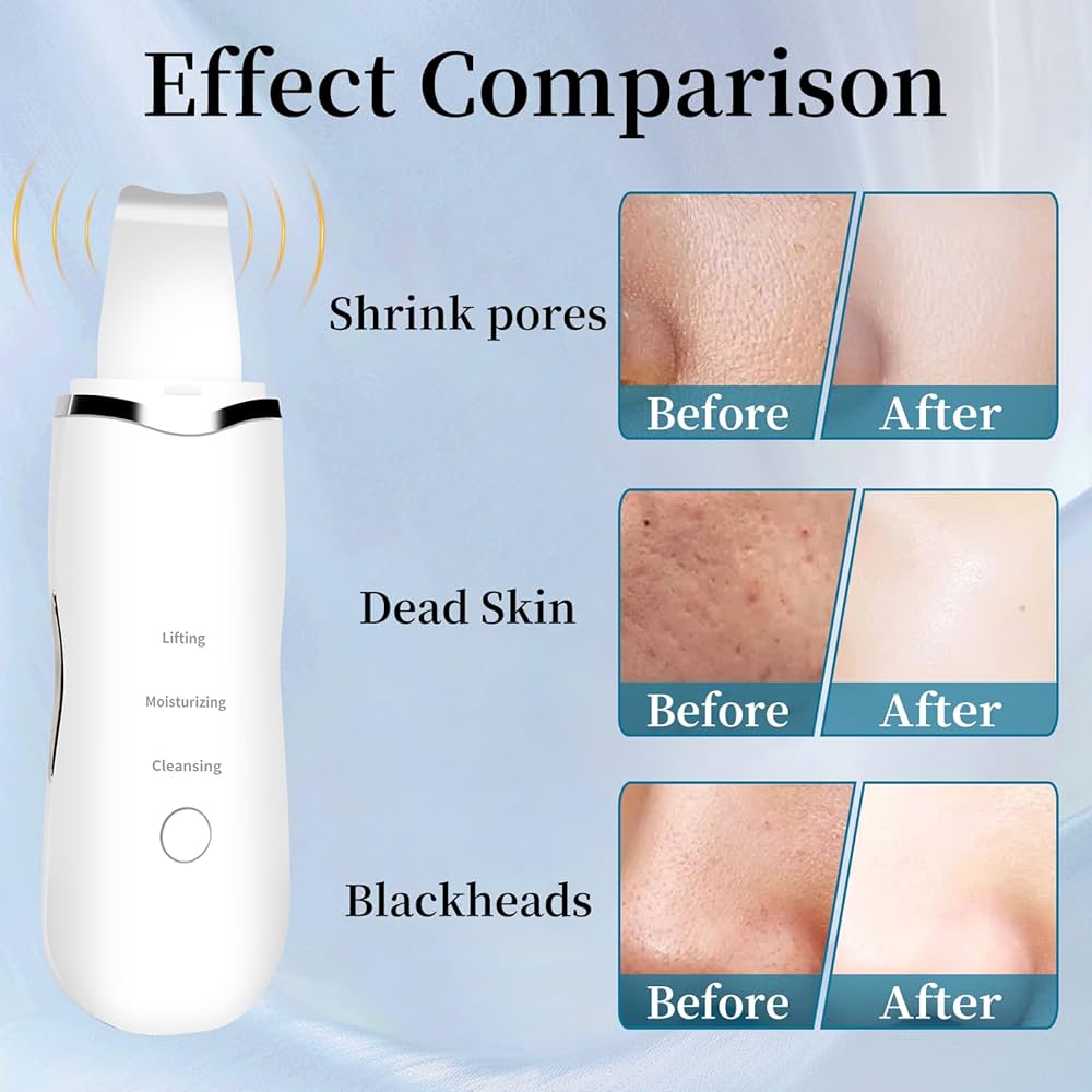 Electric blackhead pore remover
