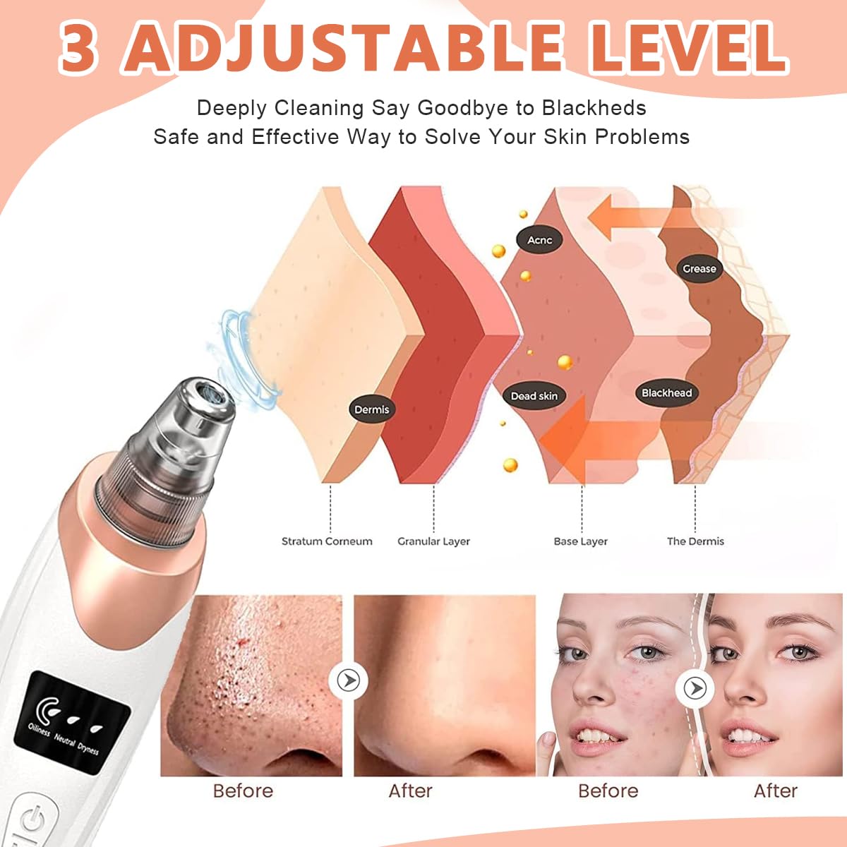 Vacum pore cleaner