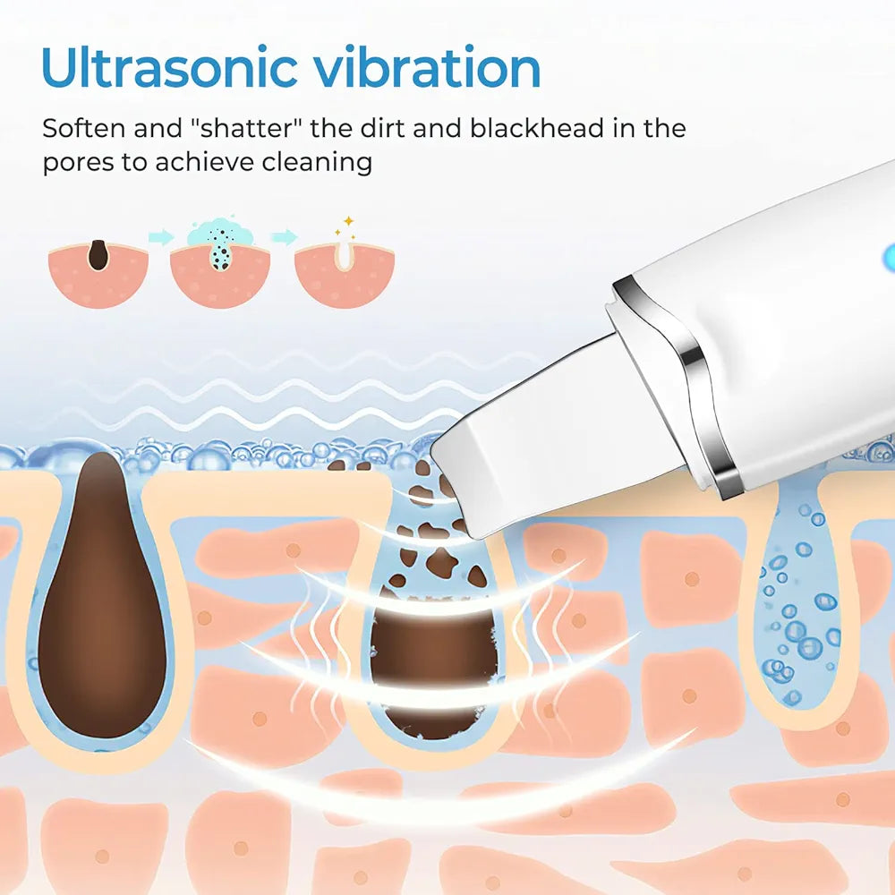 Electric blackhead pore remover